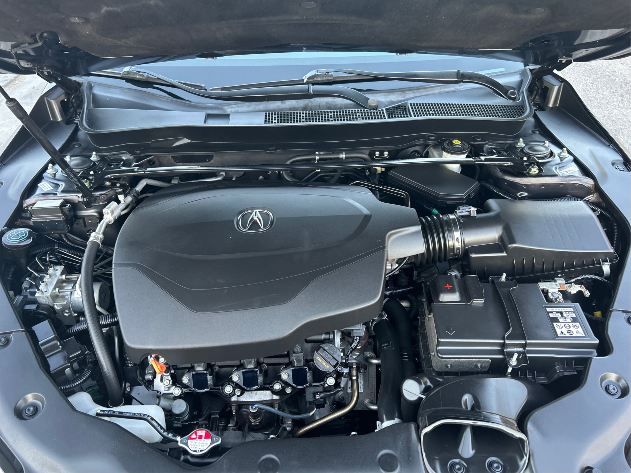 Photo 31 of this Acura TLX