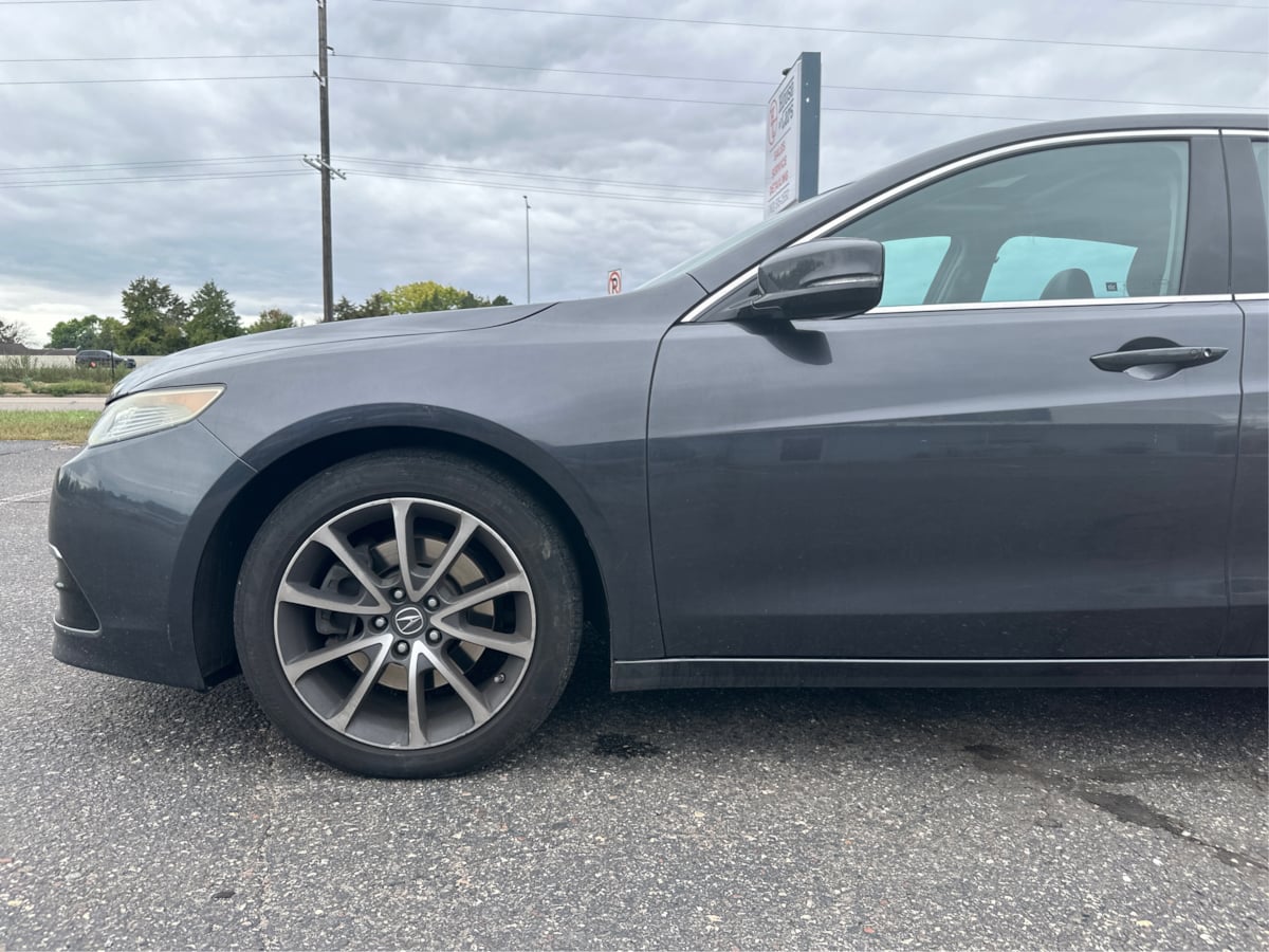 Photo 21 of this Acura TLX